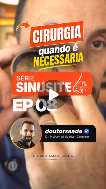QUANDO OPERAR A SINUSITE? SINAIS DE QUE A CIRURGIA PODE SER INDICADA